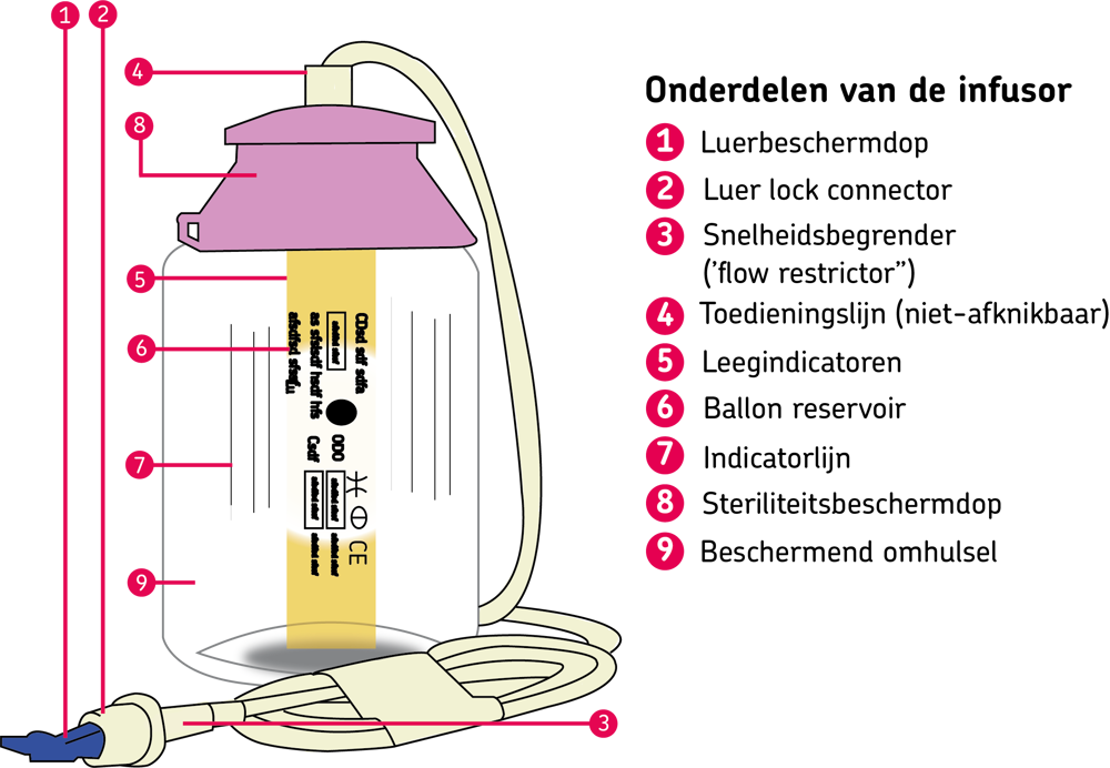 Elastomeerpomp - onderdelen van de kleine infusor